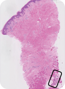 Histologia BTM: 12 meses