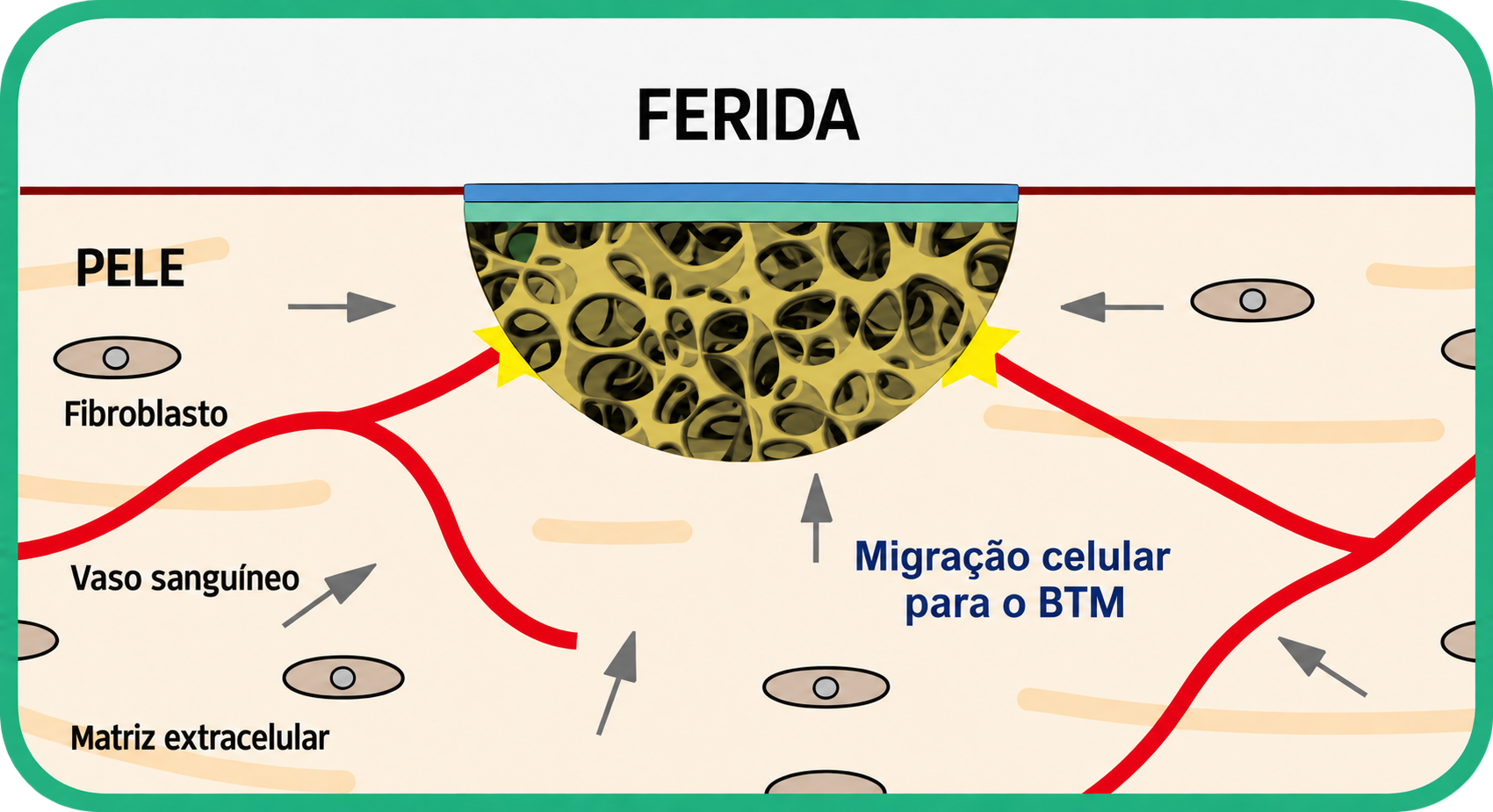 Cicatrização com NovoSorb BTM: migração celular para a matriz na ferida, com fibroblastos, vasos sanguíneos e matriz extracelular.